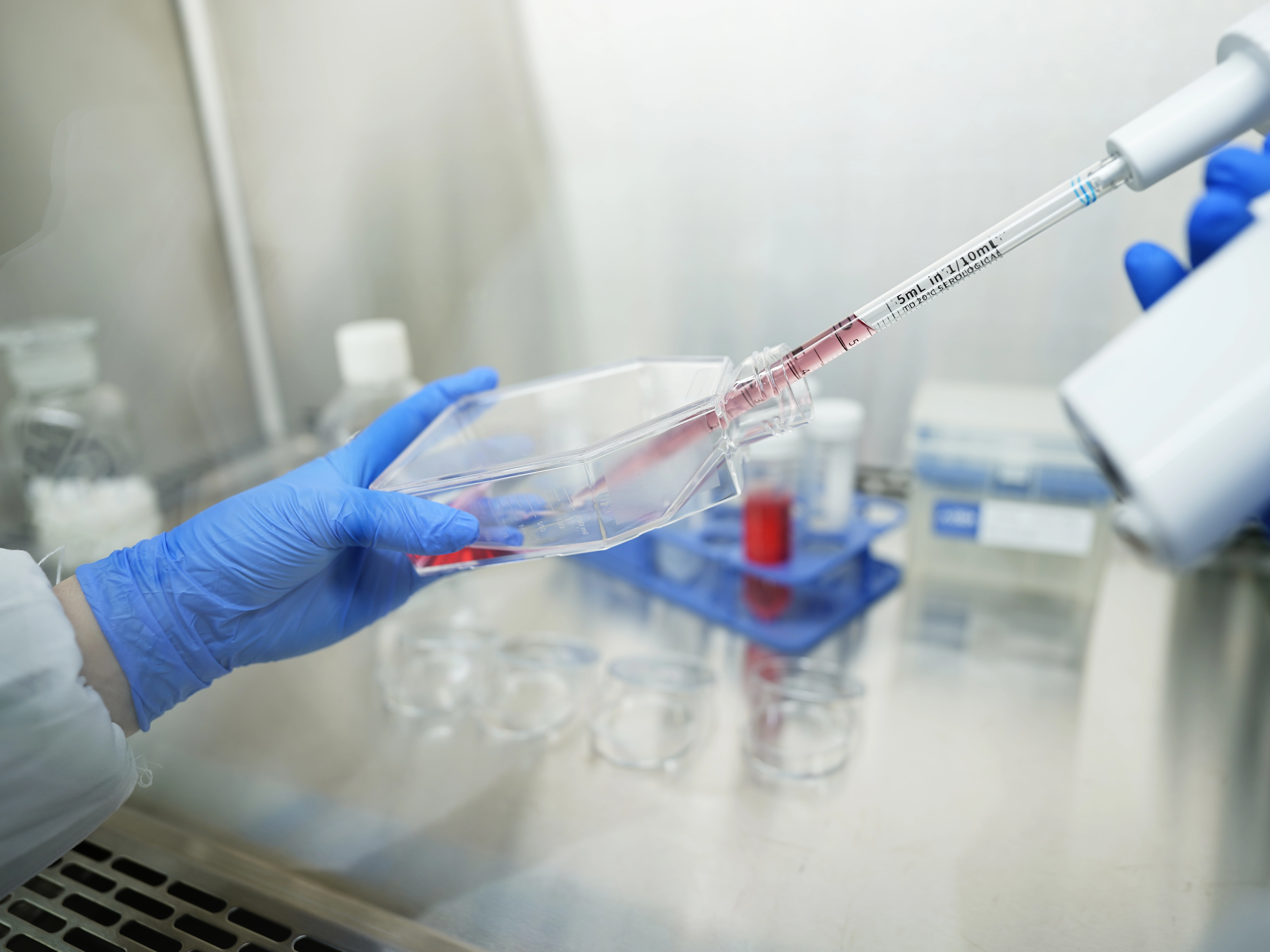 Product recommendation | How to choose culture bottles or petri dishes