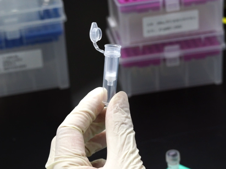Nucleic acid purification column: analysis of the principles and advantages of column membrane extraction